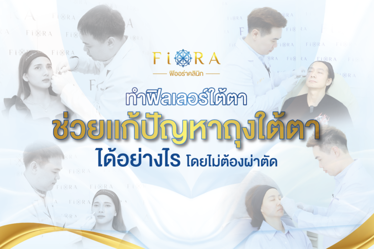 แก้ปัญหาถุงใต้ตา … โดยไม่ต้องผ่าตัด ด้วยการทำฟิลเลอร์ใต้ตา!!